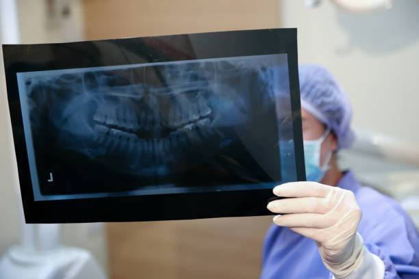 orthodontist x-ray Images
