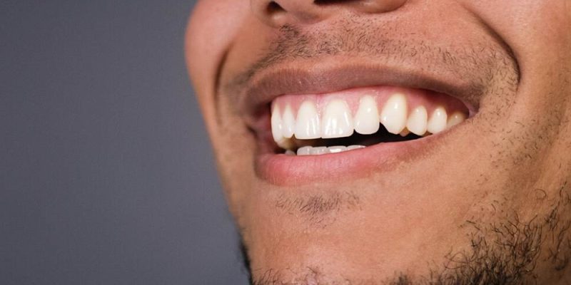 Healthy Teeth and Gums in images