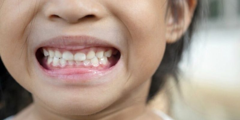 Kids dentistry Image