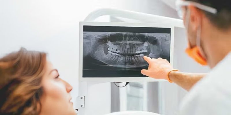 Doctor Dental X-Rays in Patient