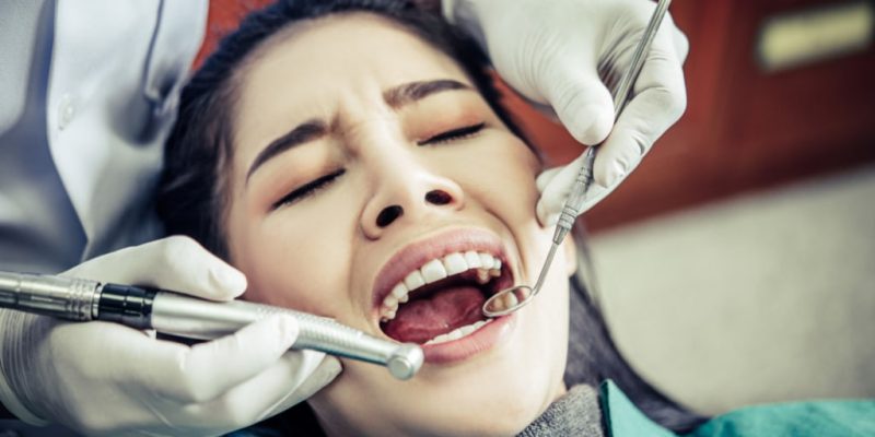Root Canal Treatment Images